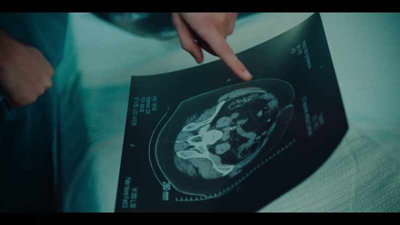 {\an8}You see, this is where the lower bowel has been most impacted