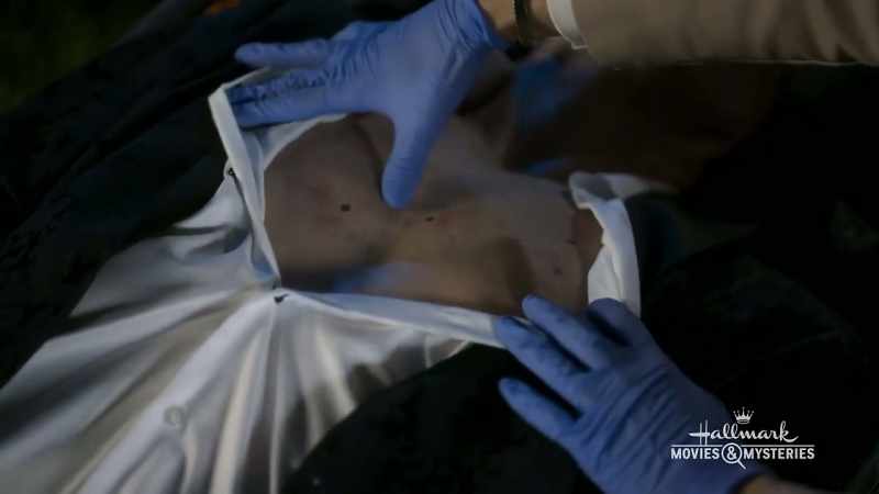 And do you see these abrasions on his wrist?