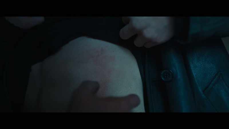 And it doesn't hurt. -Never seen anything like it