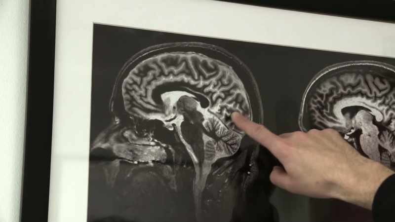 And this is a kind of spine to the cortex