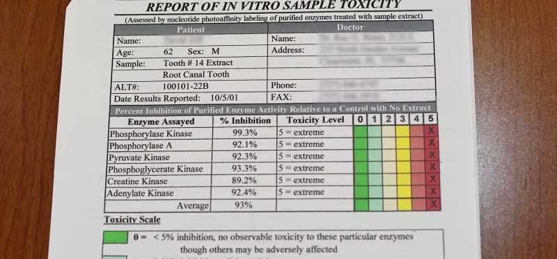 And on this particular patient, the average was 93% inhibition