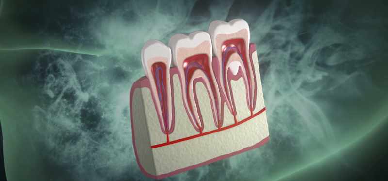 And so, when a tooth dies or becomes infected