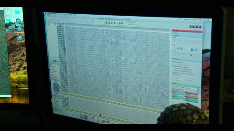 And that's what we see in the EEG activity