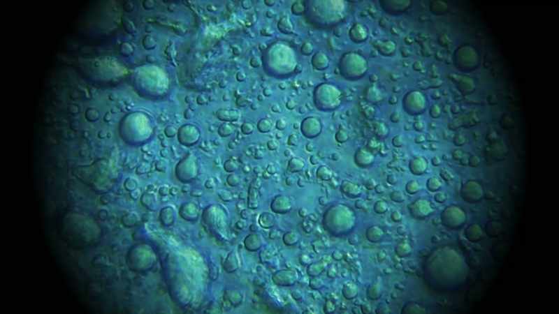 And that's when, using this technique called atomic force microscopy