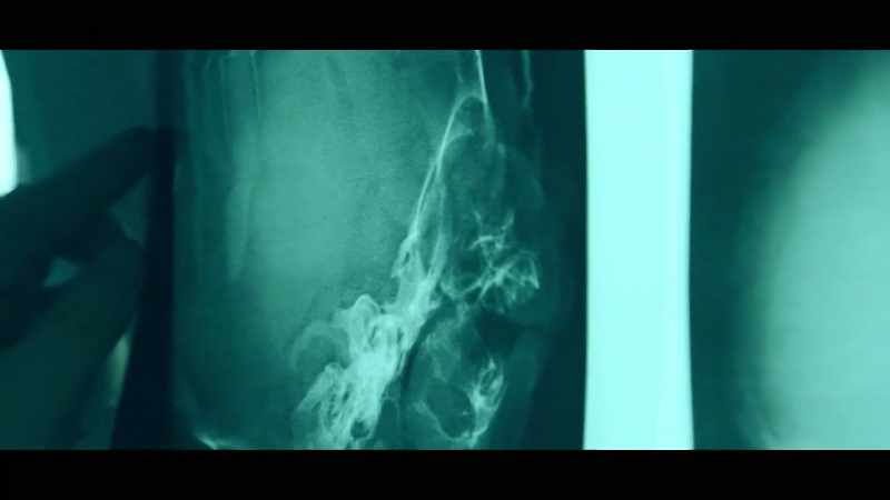 And the yield of those x-rays was