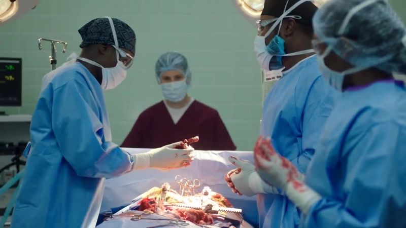 And what are we looking for, Dr. Okafor?