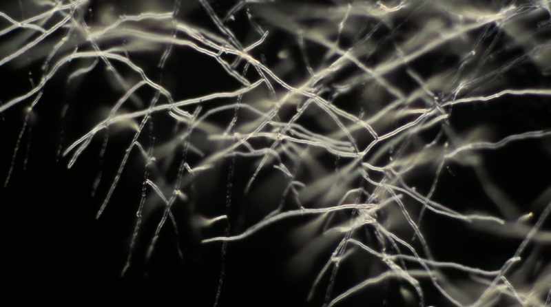 And what we know about these mycelium networks