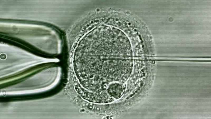 AND YOU HAVE RESEARCH EVEN COMBINING PIG EMBRYOS