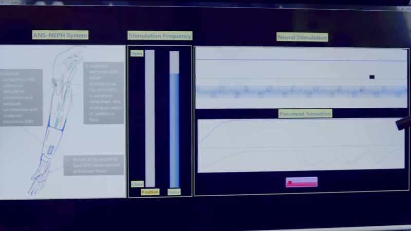 [Andres] Are you getting, uh, stimulation? Feeling sensation?