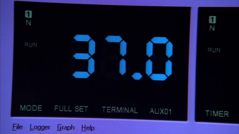 Anesthesiologist: Body temperature 37 degrees celsius