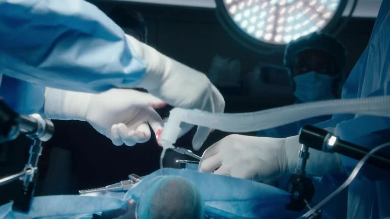 AUSTIN: Partial lung resection complete