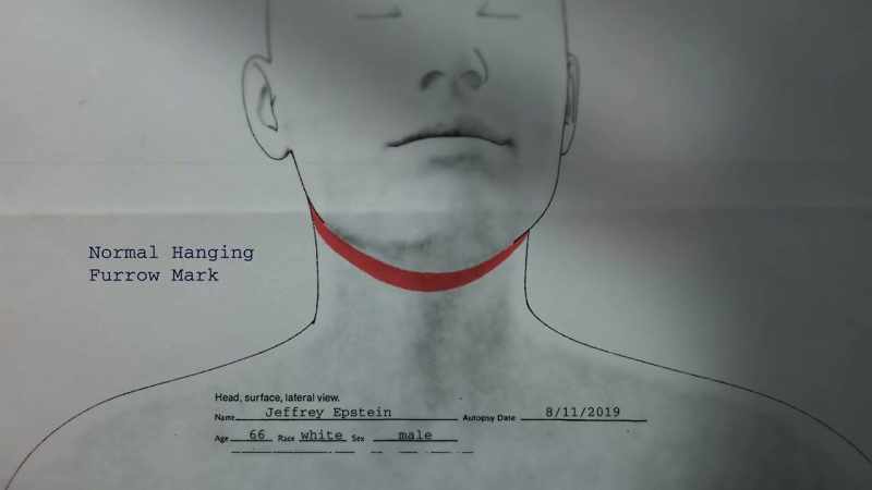 Banfield: USUALLY IN HANGINGS