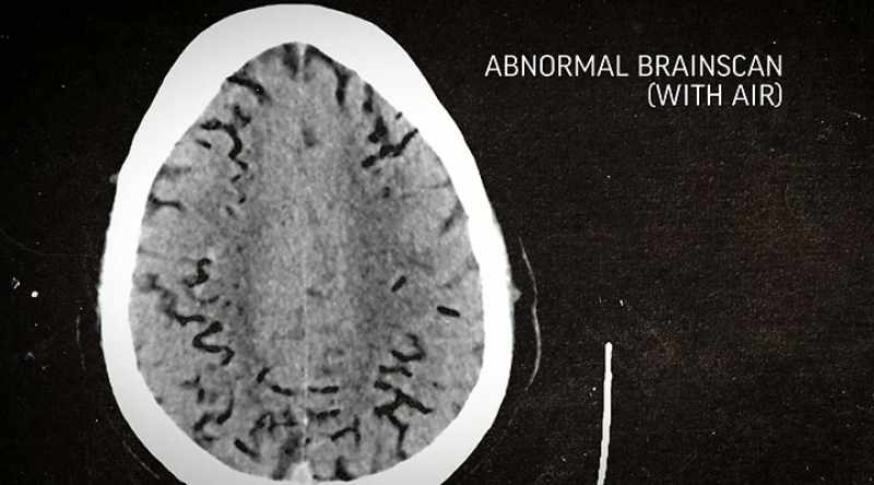 Based on the scans, experts conclude