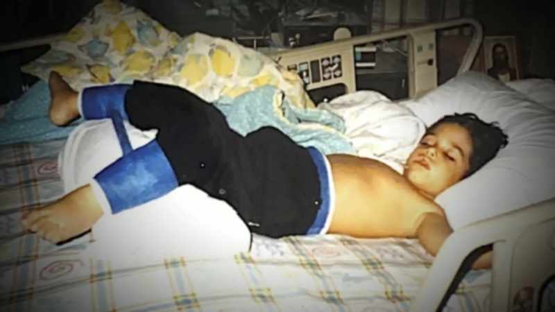 Before I started using a wheelchair