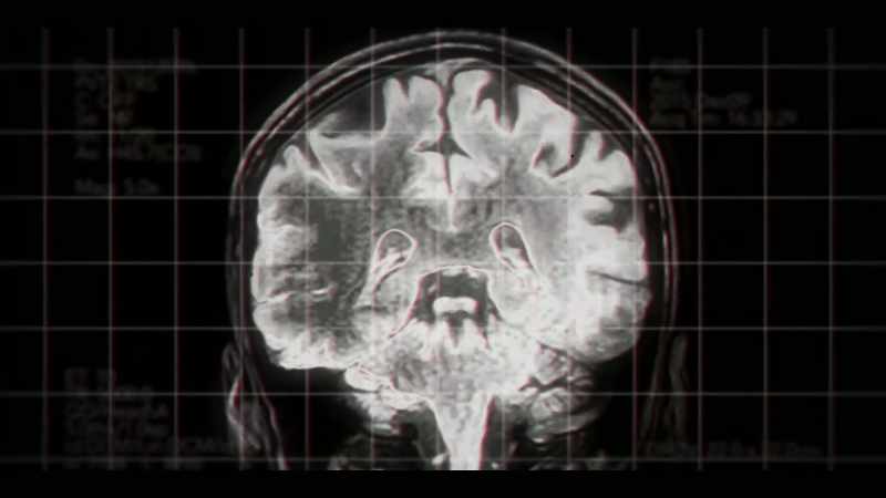 Believe you me, when the brain loses its oxygen