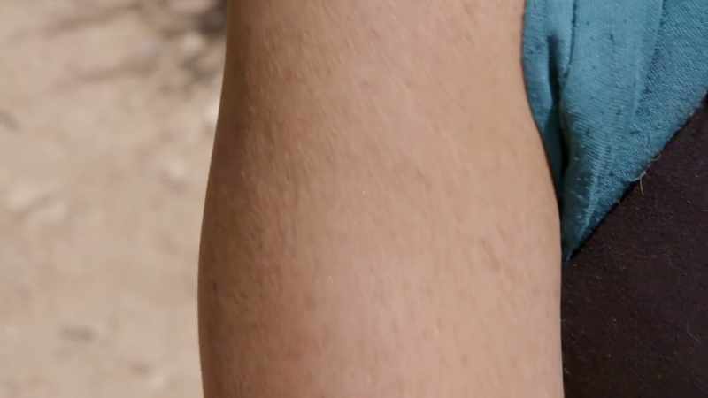 Below that top layer of skin is another one
