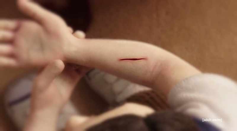 Benny told the wound he was not technically its mother