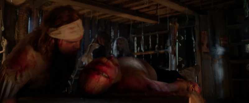 Bind it, else he chew his tongue