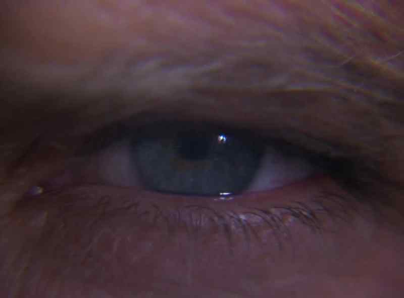 (BIONIC EYE SOUND EFFECT)