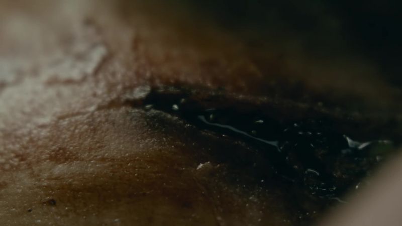 [Bjorn wincing]