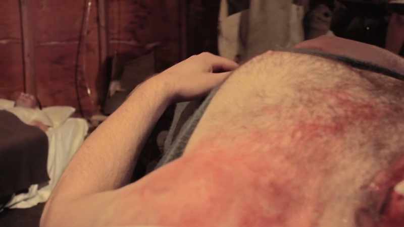 Blind and deaf, mortar shell blew up in his face