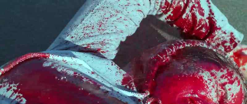 (blood gushing) (music continues)