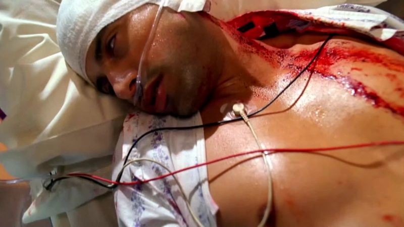 Both from gunshot, one to the left mastoid