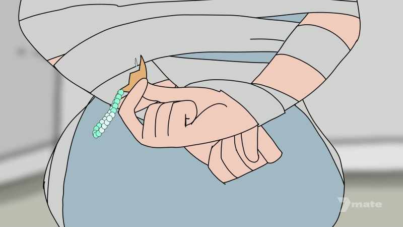 (bracelet scratches)