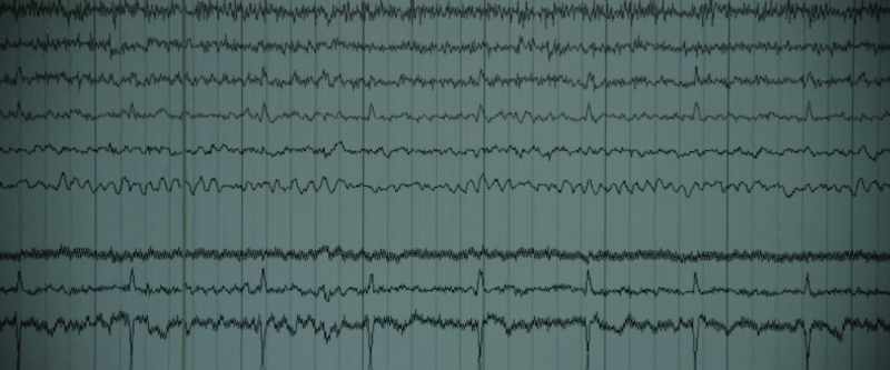 Brain waves are always present