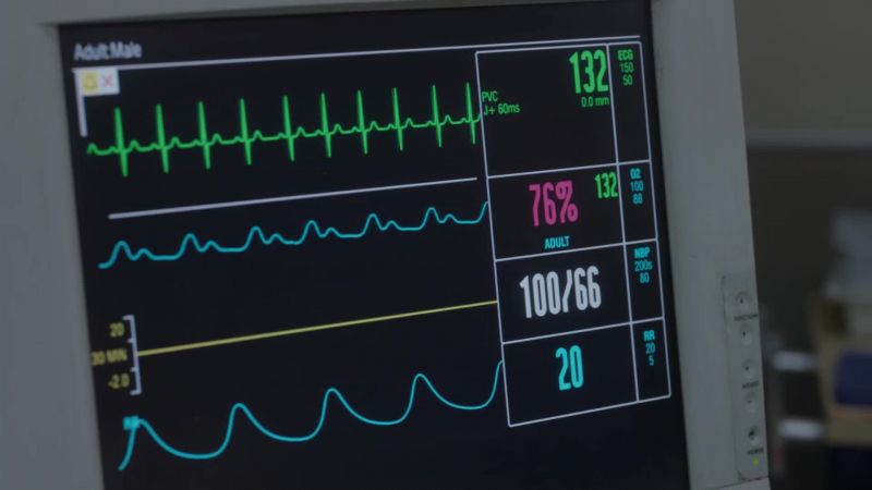 (Brett) Heart rate normalizing
