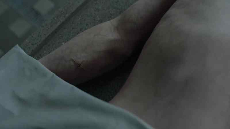 [Brigstocke] What's that on his arm?