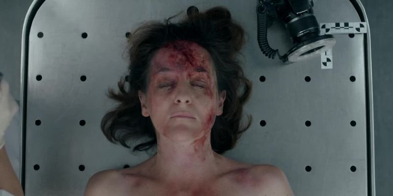 Bruising and grazes to the forehead