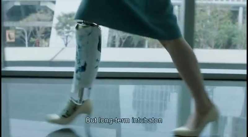 But long-term intubaton