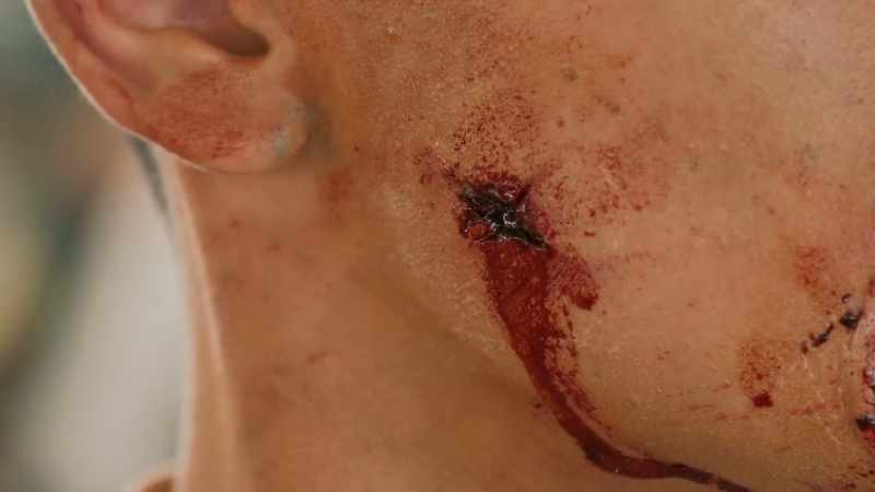 But if we had brought the actor to set, and we've got the wrong wound