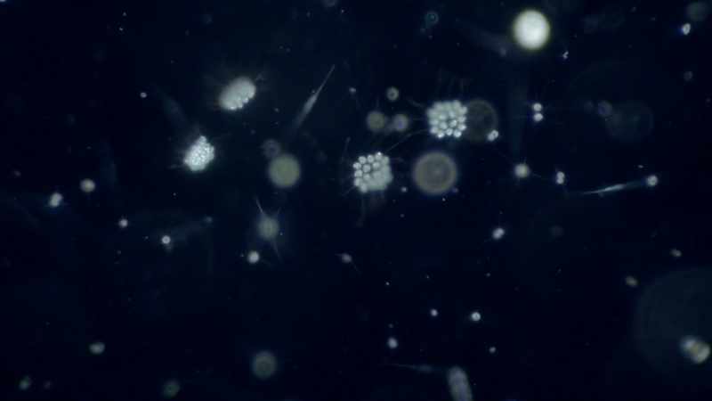 But if you look at us under a microscope, we're crawling with life