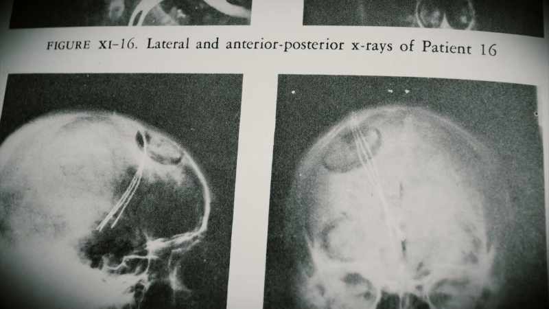 By 1952, Dr. Heath had already outfitted