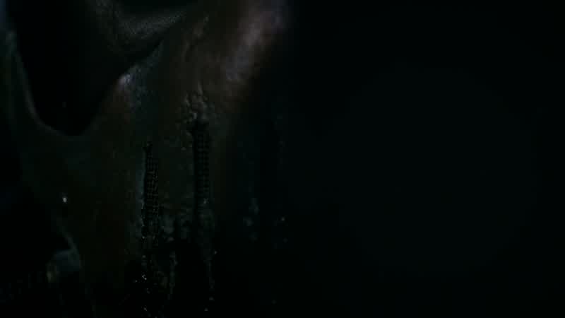 Can you keep him alive?