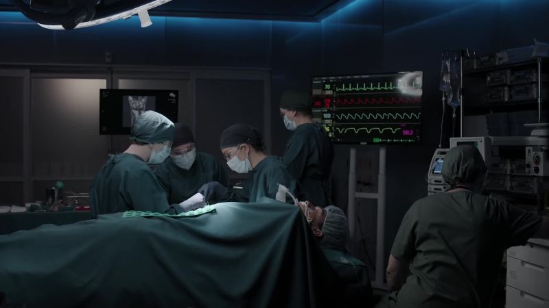 Carpal resection looks good