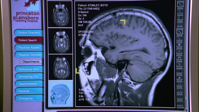 Chase: Mri shows an abnormal area