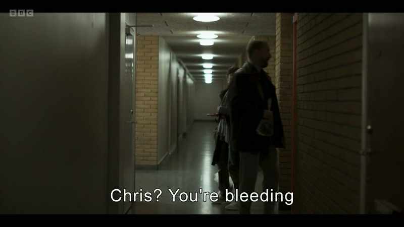 Chris? You're bleeding
