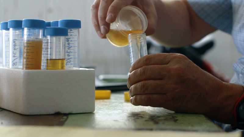 Could you imagine, the best laboratory will be puzzled with your piss?
