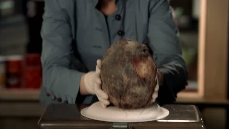 Cranial shape and nasal features suggest Caucasian