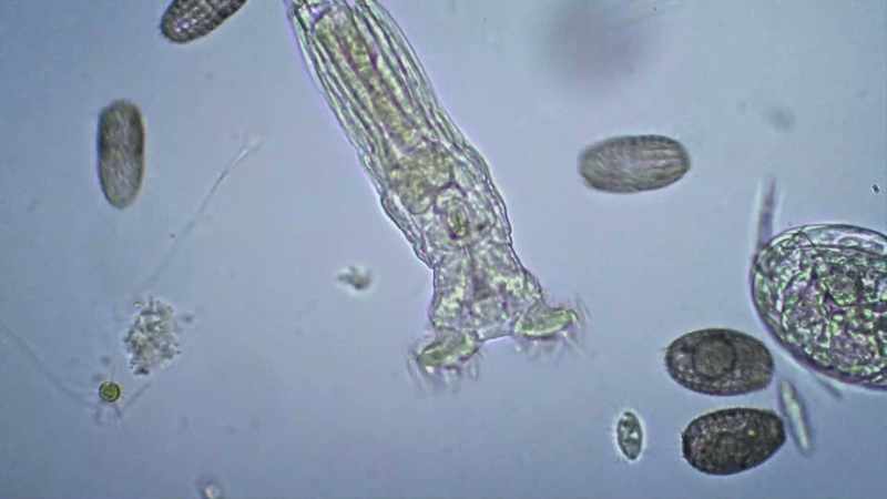 [Dan] It is the bdelloid rotifer