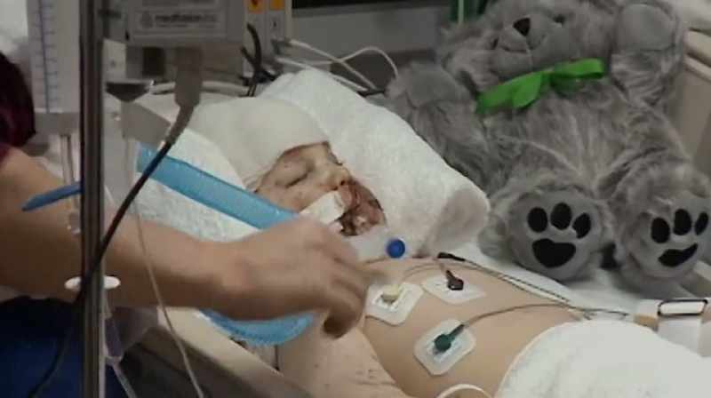 Denny: He had a piece of something blown into the upper left side
