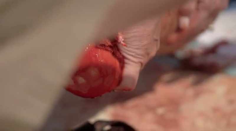DENNY (off-screen): By the time I started putting some pressure on his wounds