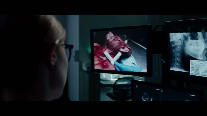 Dental ids buckethead as Malcolm neale