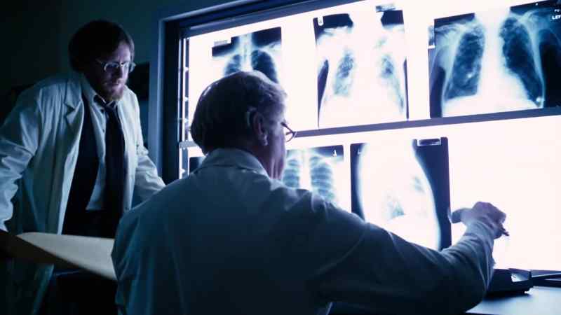 Do me a favor. - Bilateral aspiration pneumonia