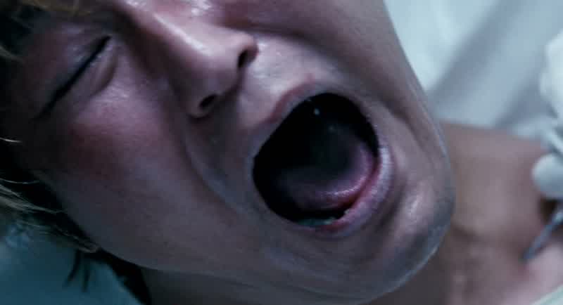 DOCTOR 1: Why's he like that?