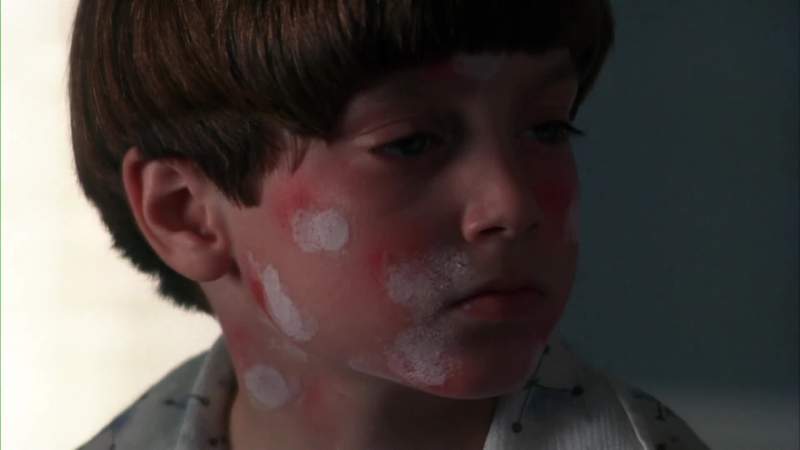 DOCTOR He's not allergic to the bees so there's no real problem