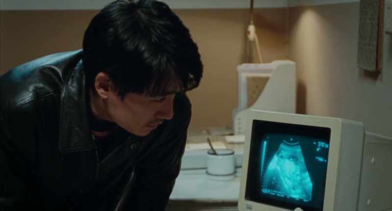 Doctor, how is our child doing?